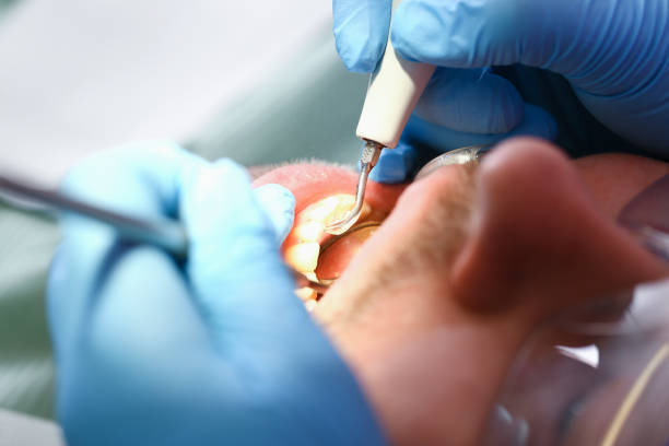 Best Cosmetic Emergency Dentistry in Cadiz, OH